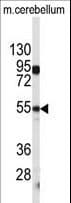 CPE / Carboxypeptidase E Antibody (aa381-412)