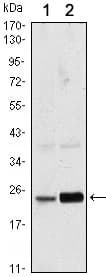 Monoclonal Mouse anti-Human RAB10 Antibody (clone 400, IF, WB)