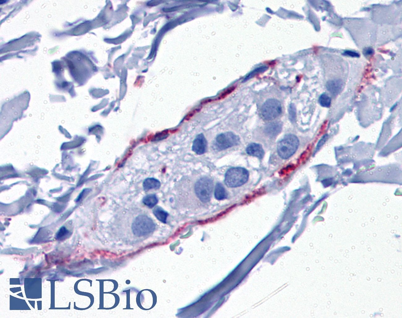 IHC-plus™ Polyclonal Rabbit anti-Human SYNPO / Synaptopodin Antibody (IHC, IF, WB)
