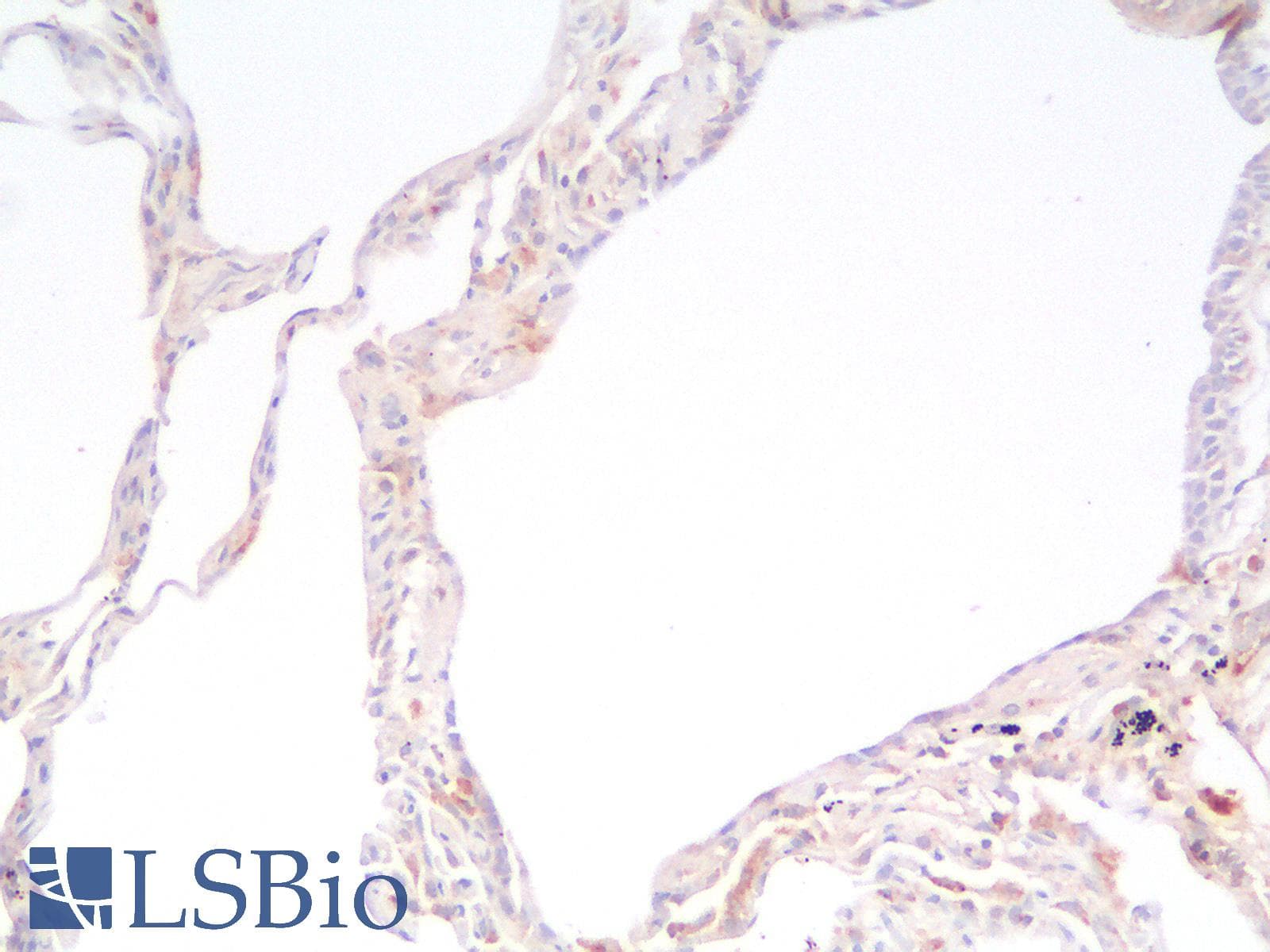 IHC-plus™ HSPD1 / HSP60 Antibody (clone rGROEL/780)