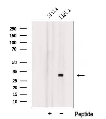 NXNL1 / TXNL6 Antibody