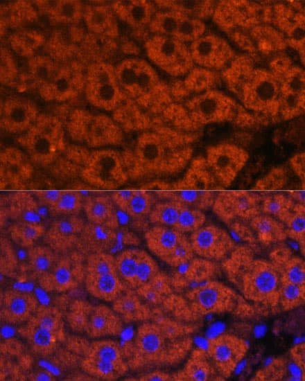 F2 / Prothrombin / Thrombin Antibody