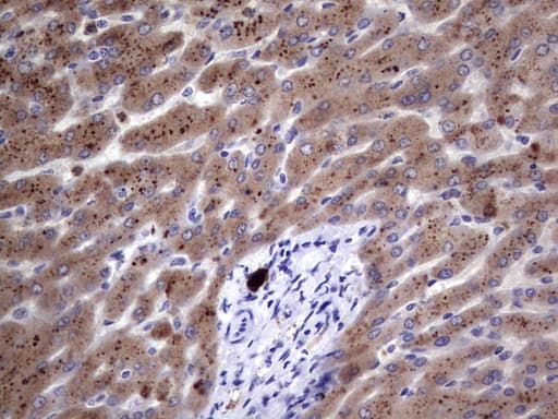 KRT19 / CK19 / Cytokeratin 19 Antibody (aa240-390, clone OTI1C11)