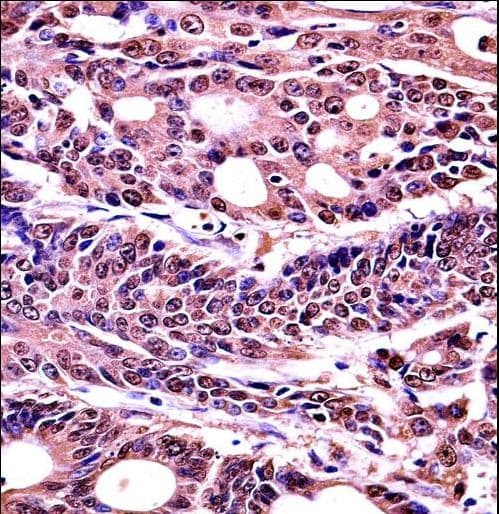 HMG1 / HMGB1 Antibody (aa152-180)
