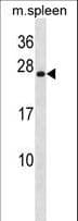 IHC-plus™ HOXB7 Antibody (aa94-122)