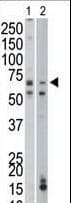 PCK1 Antibody (aa592-622)