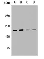 Polyclonal Rabbit anti-Human UGGT1 / UGGT Antibody (WB)