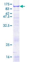 Human SELE / CD62E / E-selectin Protein (Recombinant GST)