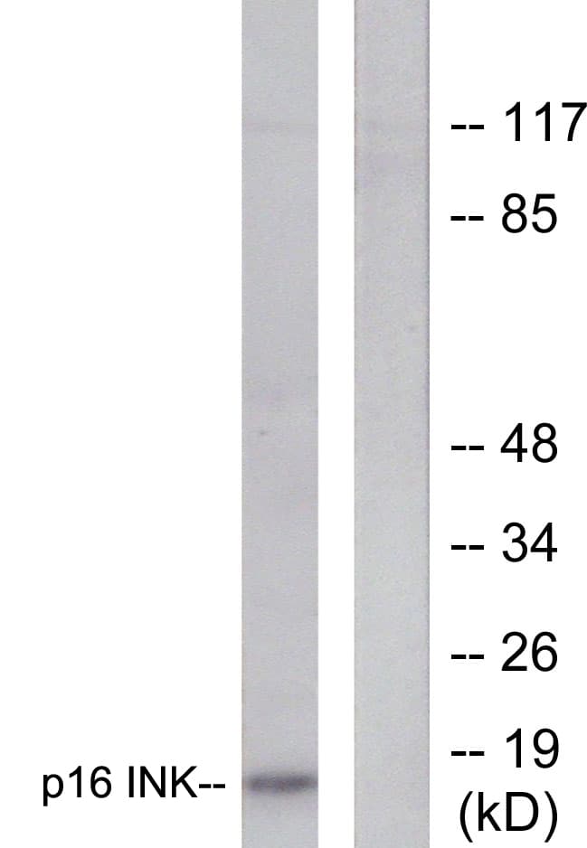 p16INK4a / CDKN2A Antibody (aa10-59)
