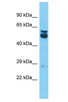 A1CF / ACF Antibody (aa6-55)
