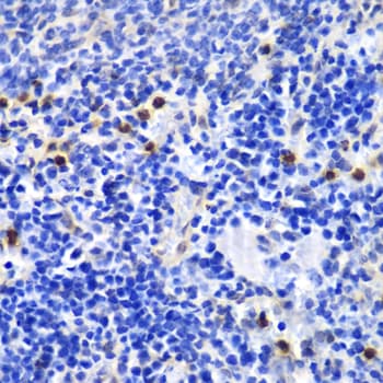 Polyclonal Rabbit anti-Human ANXA1 / Annexin A1 Antibody (IHC, IF, WB)