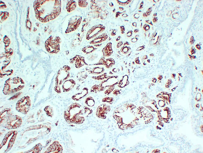 Monoclonal Mouse anti-Human AMACR / P504S Antibody (clone ABT-AMACR, IHC, WB)