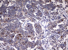 Monoclonal Mouse anti-Human TOP2A / Topoisomerase II Alpha Antibody (clone OTI2F8, aa1100-1531, IHC, WB)