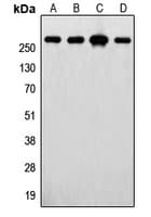 IHC-plus™ FASN / Fatty Acid Synthase Antibody (Internal)