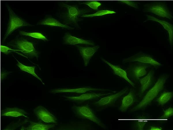 ALOX15B / 15-LOX-2 Antibody (clone 4A7)