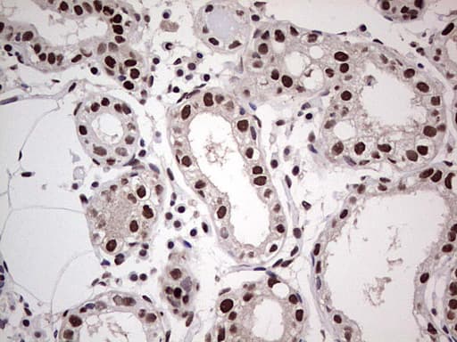 SAE1 Antibody (clone OTI3C3)
