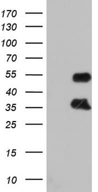 FOSB Antibody (aa1-255, clone OTI6F3)