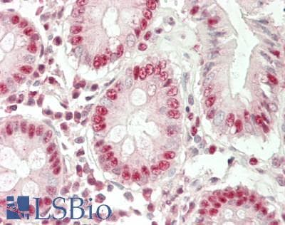 IHC-plus™ DBP5 / SON Antibody (aa1413-1628)