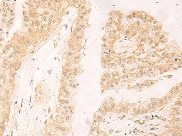 RBX1 / ROC1 Antibody