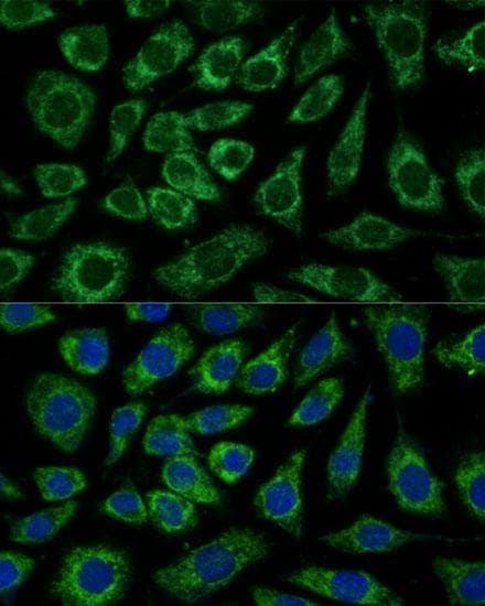 Polyclonal Rabbit anti-Human NDUFA4 Antibody (IF)