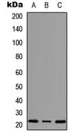 Polyclonal Rabbit anti-Human MRPS18A Antibody (Internal, IHC, WB)