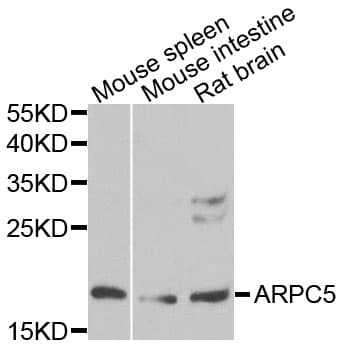 Polyclonal Rabbit anti-Human ARPC5 / p16-Arc Antibody (WB)