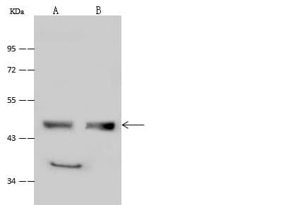 LTBR Antibody (Preservative Free)