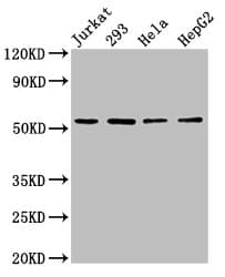 Polyclonal Rabbit anti-Human SLC16A12 / MCT12 Antibody (IHC, WB)