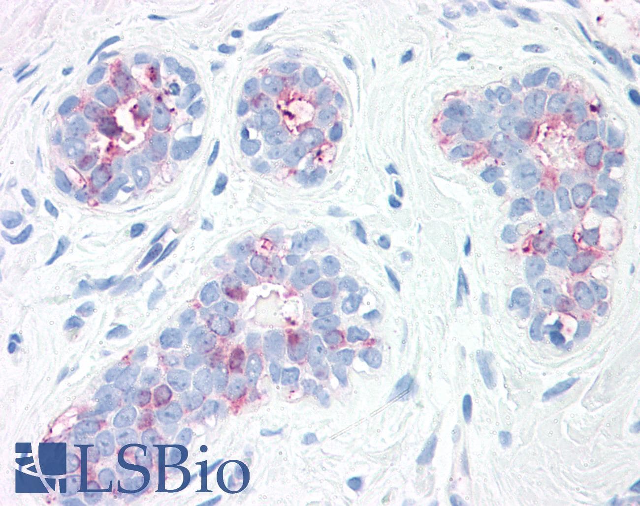 IHC-plus™ Polyclonal Rabbit anti-Human SYNGR2 / Synaptogyrin 2 Antibody (Internal, IHC)