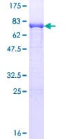 Human UAP1 Protein (Recombinant GST)