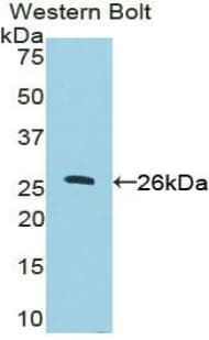 NCL / Nucleolin Antibody (aa388-569, Biotin)
