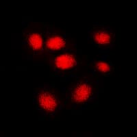 HNRNPC / HNRNP C Antibody (C-Terminus)