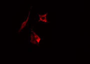 Polyclonal Rabbit anti-Human HLA-DOB Antibody (IF, WB)