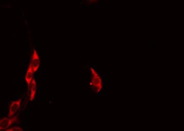 Polyclonal Rabbit anti-Human HCCS Antibody (IHC, IF, WB)