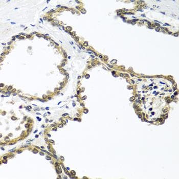 ARSF / Arylsulfatase F Antibody