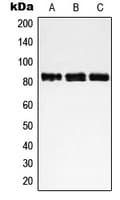 Polyclonal Rabbit anti-Human NCAPH / CAP-H Antibody (Internal, WB)