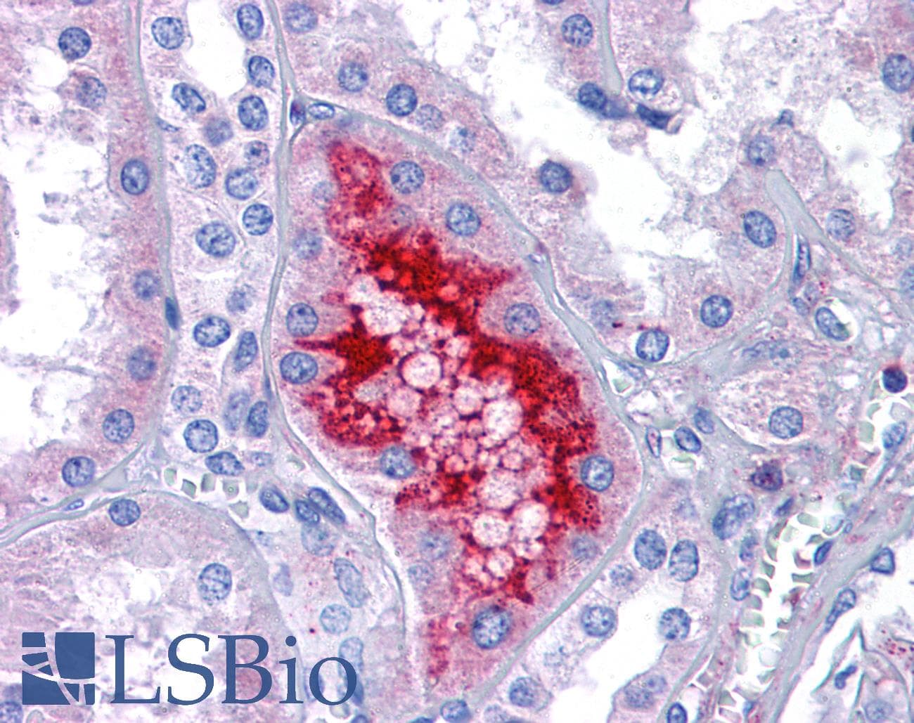 IHC-plus™ MATN1 / Matrilin 1 Antibody