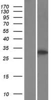TCF7 Protein (Over-Expression Lysate Myc-DDK (Flag))
