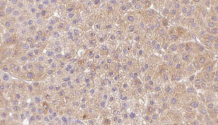 LDHAL6A Antibody