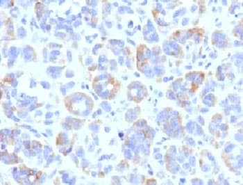 TYRP1 / gp75 Antibody (clone TYRR1-1)