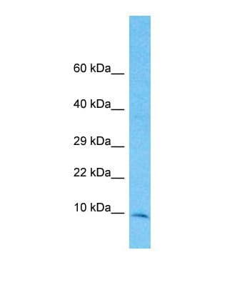 TIMM10 Antibody (C-Terminus)