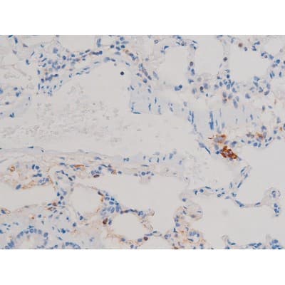 Polyclonal Rabbit anti-Human CDC25A Antibody (phospho-Ser124, IHC, IF, WB)