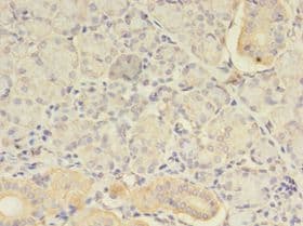 ATXN3 / JOS Antibody (aa1-288)