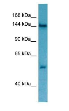 TPP2 Antibody (aa50-99)