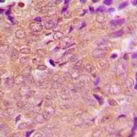 Polyclonal Rabbit anti-Human GLB1 / Beta-Galactosidase Antibody (Internal, IHC, WB)