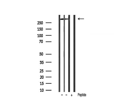 MKI67 / Ki67 Antibody