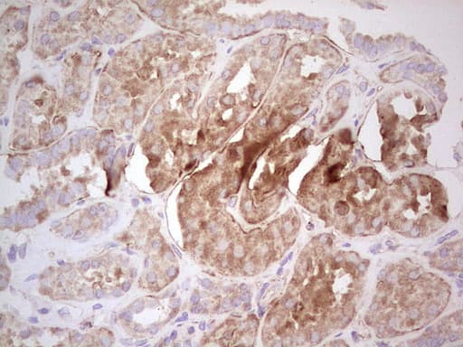 UBE2D2 / UBCH5B Antibody (clone OTI2C2)