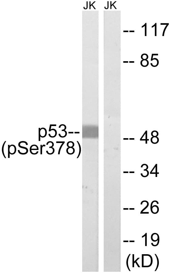 TP53 / p53 Antibody (phospho-Ser378)