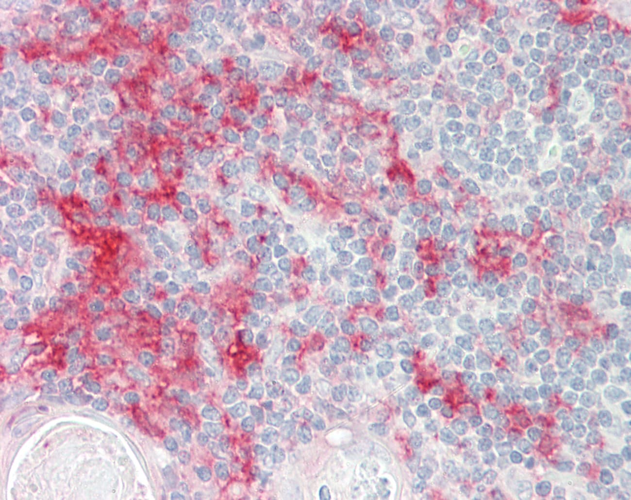 IHC-plus™ TOPAZ1 Antibody