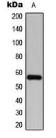 Polyclonal Rabbit anti-Human CDKL2 Antibody (Internal, IHC, WB)